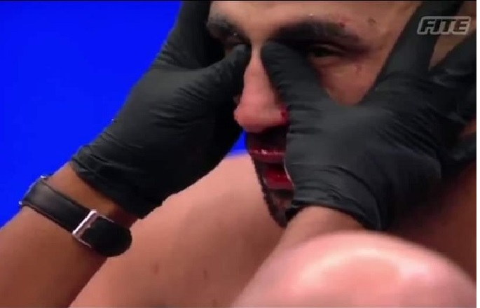 Badr Hari perd son combat face à Benjamin Adegbuyi 1 Badr Hari perd son combat face à Benjamin Adegbuyi