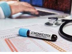 variole du singe:  Comment se protéger…