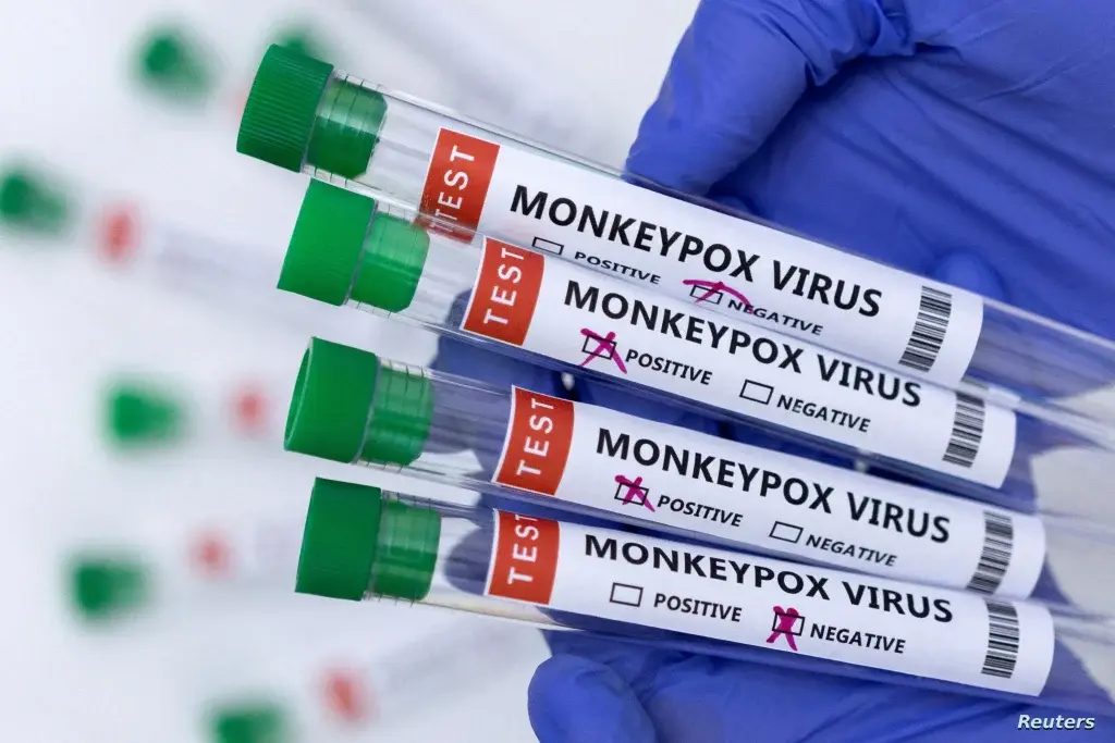 Après avoir détecté le premier cas de variole du singe au Maroc… voici 5 étapes simples pour vous protéger de l’infection