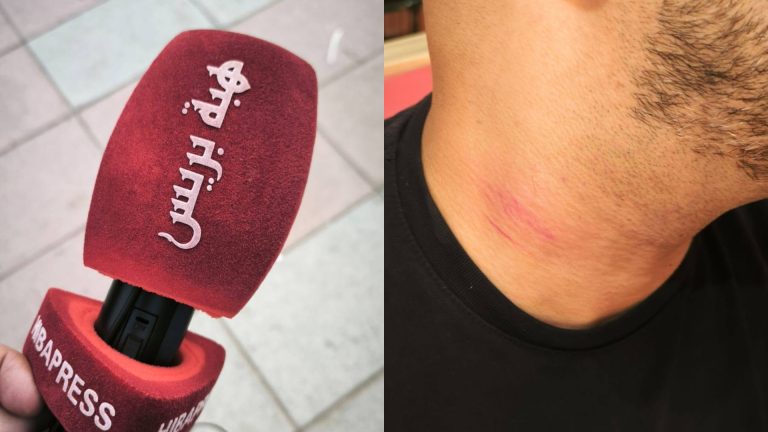Ceuta occupée: la police espagnole agresse un correspondant de HIBAPRESS lors de l'exercice de ses fonctions