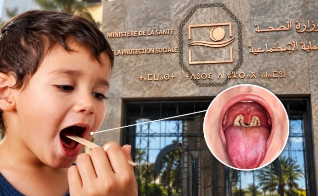 Des médecins et experts mettent en garde contre le retour de la diphtérie et appellent à renforcer la vaccination et la communication sanitaire